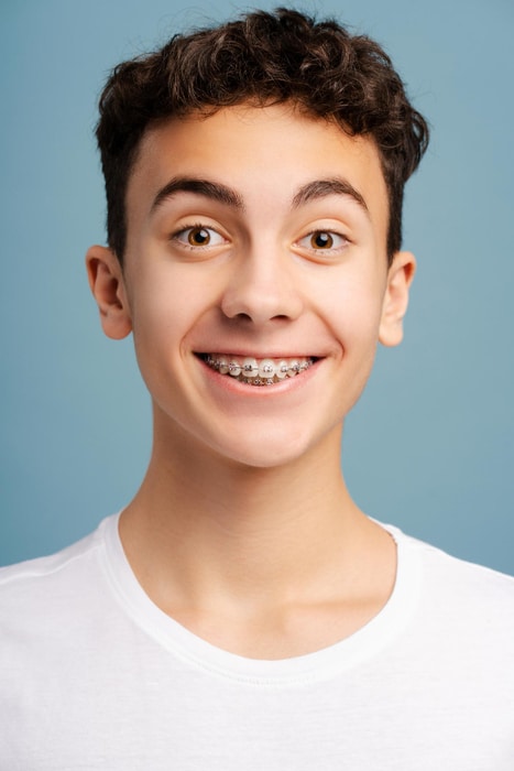 Orthodontic braces on teeth